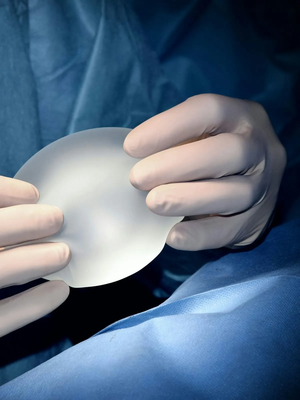 Gloved hands holding a silicone breast implant over a blue surgical drape
